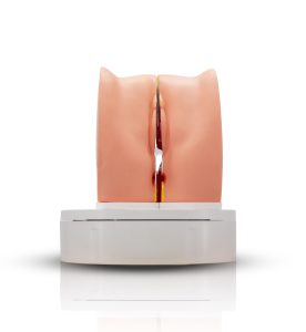 vulva
