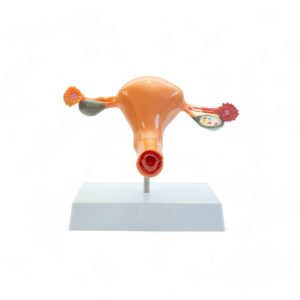 Útero con corte transversal...