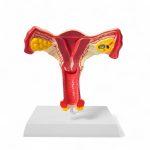 Modelo anatómico del útero y ovarios en vista frontal: herramienta educativa para salud sexual y ginecología